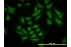 Immunofluorescence (IF) image for anti-SMAD Specific E3 Ubiquitin Protein Ligase 1 (SMURF1) antibody (ABIN781919) (SMURF1 抗体)