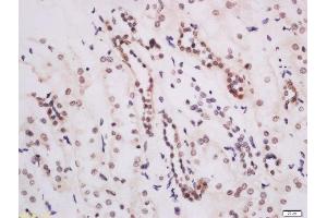 Formalin-fixed and paraffin embedded human kidney labeled with Anti-DOT1L Polyclonal Antibody, Unconjugated  at 1:200 followed by conjugation to the secondary antibody and DAB staining.