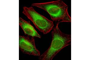 Fluorescent image of Hela cells stained with USP51 Antibody (Center) C. (USP51 抗体  (AA 278-307))