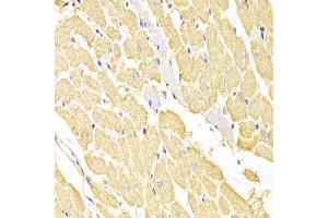 Immunohistochemistry of paraffin-embedded rat heart using RRM2 antibody at dilution of 1:100 (x400 lens). (RRM2 抗体)