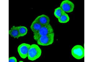 Immunofluorescence analysis of CRC cells using LYZ antibody (ABIN5997039). (LYZ 抗体)