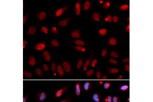 Immunofluorescence analysis of U2OS cells using HUS1 Polyclonal Antibody (HUS1 抗体)