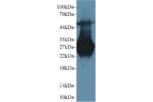 Western Blotting (WB) image for Mannose-Binding Lectin (Protein C) 2, Soluble (MBL2) ELISA Kit (ABIN6574279)