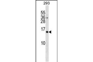 Western blot analysis in 293 cell line lysates (35ug/lane). (SH2D1A 抗体  (C-Term))