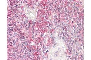 Anti-BID antibody IHC of human spleen. (BID 抗体)