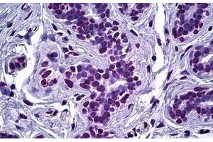 Human Breast, Epithelium: Formalin-Fixed, Paraffin-Embedded (FFPE) (ELAC2 抗体  (AA 161-210))