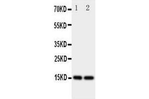 Western Blotting (WB) image for anti-Fatty Acid Binding Protein 5 (Psoriasis-Associated) (FABP5) (AA 10-23), (N-Term) antibody (ABIN3044084) (FABP5 抗体  (N-Term))