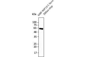 Western Blotting (WB) image for anti-SARS-CoV-2 Helicase (NSP13) (HEL) (C-Term) antibody (ABIN7273005) (SARS-CoV-2 NSP13 抗体  (C-Term))