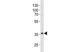 Western Blotting (WB) image for anti-Glyceraldehyde-3-Phosphate Dehydrogenase (GAPDH) (AA 62-91) antibody (ABIN3029800)