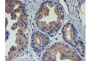 Immunohistochemical staining of paraffin-embedded Human breast tissue using anti-VCAM1 mouse monoclonal antibody. (VCAM1 抗体)