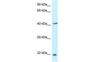 Image no. 1 for anti-Tumor Protein D52-Like 2 (TPD52L2) (AA 118-167) antibody (ABIN6747351) (TPD52L2 抗体  (AA 118-167))
