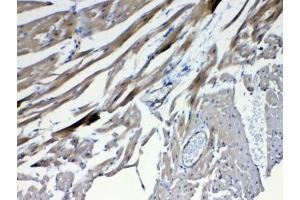 IHC testing of FFPE mouse heart tissue with FZD4 antibody at 1ug/ml. (FZD4 抗体)