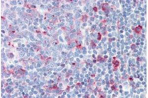 Human Tonsil: Formalin-Fixed, Paraffin-Embedded (FFPE) (CTSC 抗体)