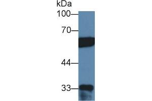Western blot analysis of Human HeLa cell lysate, using Human PTBP1 Antibody (2 µg/ml) and HRP-conjugated Goat Anti-Rabbit antibody ( (PTBP1 抗体  (AA 1-531))