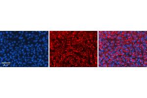 Rabbit Anti-PROC Antibody   Formalin Fixed Paraffin Embedded Tissue: Human Liver Tissue Observed Staining: Cytoplasm in hepatocytes Primary Antibody Concentration: 1:100 Other Working Concentrations: 1:600 Secondary Antibody: Donkey anti-Rabbit-Cy3 Secondary Antibody Concentration: 1:200 Magnification: 20X Exposure Time: 0. (PROC 抗体  (Middle Region))