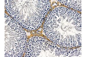 ABIN6258237 and ABIN6274591 at 1/100 staining rat testis tissue by IHC-P. (AVEN 抗体  (C-Term))