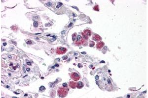 Human Lung: Formalin-Fixed, Paraffin-Embedded (FFPE) (FAM59B 抗体  (C-Term))