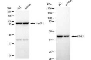 Western blotting analysis using DDB2 antibody (ABIN7798274). (Recombinant DDB2 抗体)