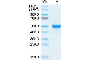 Mouse CD5L on Tris-Bis PAGE under reduced condition. (CD5L Protein (AA 22-352) (His tag))