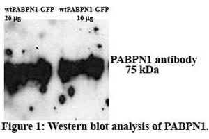 Western Blotting (WB) image for anti-Poly A Binding Protein Nuclear 1 (PABPN1) (N-Term) antibody (ABIN2778908)