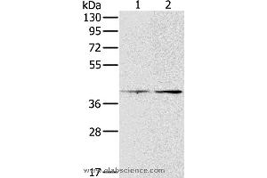 Western blot analysis of Hela and lovo cell, using PDGFRL Polyclonal Antibody at dilution of 1:400 (PDGFRL 抗体)