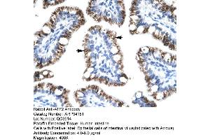 Human Intestine (ATF2 抗体  (C-Term))