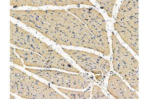 ABIN7096733 and ABIN7100798 at 1/100 staining rat muscle tissue by IHC-P. (TRABD 抗体)