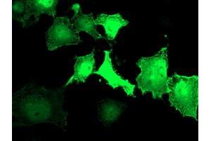 Anti-LDLRAP1 mouse monoclonal antibody (ABIN2455230) immunofluorescent staining of COS7 cells transiently transfected by pCMV6-ENTRY LDLRAP1 (RC206643). (LDLRAP1 抗体)