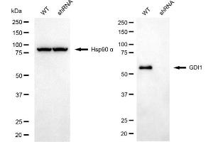Western blotting analysis using GDI1 antibody (ABIN7798699).
