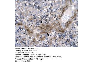 Rabbit Anti-ZNF365 Antibody  Paraffin Embedded Tissue: Human Liver Cellular Data: Hepatocyte Antibody Concentration: 4. (ZNF365 抗体  (N-Term))