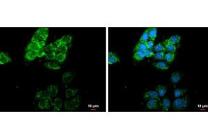 ICC/IF Image MMP13 antibody [N3C1], Internal detects MMP13 protein at cytoplasm by immunofluorescent analysis. (MMP13 抗体)