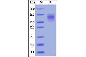 SDS-PAGE (SDS) image for Carcinoembryonic Antigen-Related Cell Adhesion Molecule 6 (CEACAM6) (AA 35-320) (Active) protein (His tag,AVI tag,Biotin) (ABIN6731313)