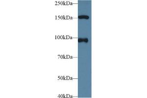 Western blot analysis of Human HeLa cell lysate, using Human NUP98 Antibody (1 µg/ml) and HRP-conjugated Goat Anti-Rabbit antibody ( (NUP98 抗体  (AA 629-894))