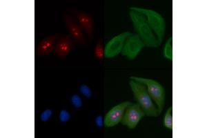 ABIN6263193 and ABIN6266724 staining Hela cells by IF/ICC. (MED24 抗体  (C-Term))