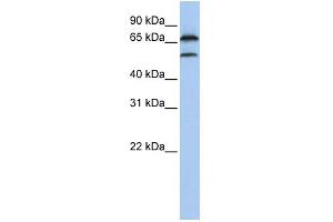 WB Suggested Anti-FBXO7 Antibody Titration:  0.