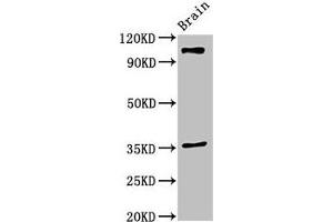 Western Blot Positive WB detected in: Mouse brain tissue All lanes: SLITRK5 antibody at 2 μg/mL Secondary Goat polyclonal to rabbit IgG at 1/50000 dilution Predicted band size: 108, 80 kDa Observed band size: 108 kDa (SLITRK5 抗体  (AA 617-890))