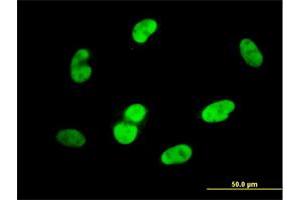 Immunofluorescence (IF) image for anti-SRY (Sex Determining Region Y)-Box 9 (SOX9) (AA 400-509) antibody (ABIN520383)