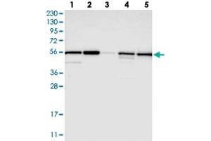 Western blot analysis of Lane 1: RT-4, Lane 2: U-251 MG, Lane 3: Human Plasma, Lane 4: Liver, Lane 5: Tonsil with PMPCA polyclonal antibody  at 1:250-1:500 dilution.