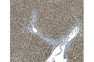 IHC analysis of ASS1 using anti-ASS1 antibody (ABIN7601191). (ASS1 抗体  (AA 3-365))