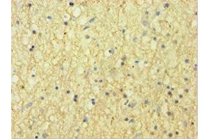 Immunohistochemistry of paraffin-embedded human brain tissue using ABIN7145442 at dilution of 1:100 (CNDP1 抗体  (AA 1-280))