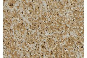 Immunohistochemistry (IHC) image for anti-Mitochondrial Ribosomal Protein L13 (MRPL13) (C-Term) antibody (ABIN6258512)