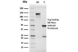 SDS-PAGE Analysis Purified MCAM Mouse Monoclonal Antibody (MCAM/3046). (MCAM 抗体  (AA 226-374))