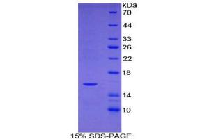SDS-PAGE (SDS) image for Tryptase delta 1 (TPSD1) (AA 99-191) protein (His tag) (ABIN1879863)
