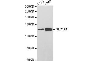 Western Blotting (WB) image for anti-Solute Carrier Family 4, Sodium Bicarbonate Cotransporter, Member 4 (SLC4A4) antibody (ABIN1876520) (SLC4A4 抗体)