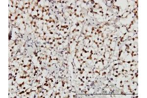 Image no. 3 for anti-Ubiquitin Specific Peptidase 34 (USP34) (AA 3296-3396) antibody (ABIN599094) (USP34 抗体  (AA 3296-3396))