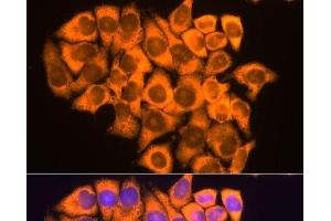 Immunofluorescence analysis of HeLa cells using RPL17 Polyclonal Antibody at dilution of 1:100. (RPL17 抗体)