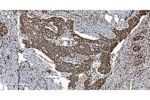 IHC analysis of Ku70 using anti-Ku70 antibody (ABIN7602790).