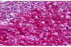 Anti-NF1 antibody IHC staining of human tonsil. (Neurofibromin 1 抗体  (AA 1551-1600))
