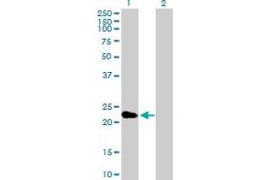 Western Blot analysis of CRYBA2 expression in transfected 293T cell line by CRYBA2 MaxPab polyclonal antibody. (CRYbA2 抗体  (AA 1-197))