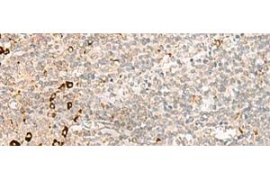 Immunohistochemistry of paraffin-embedded Human tonsil tissue using RMND5A Polyclonal Antibody at dilution of 1:50(x200) (RMND5A 抗体)